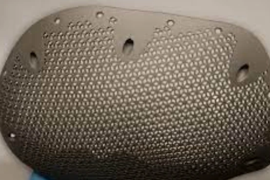 titanium skull plate